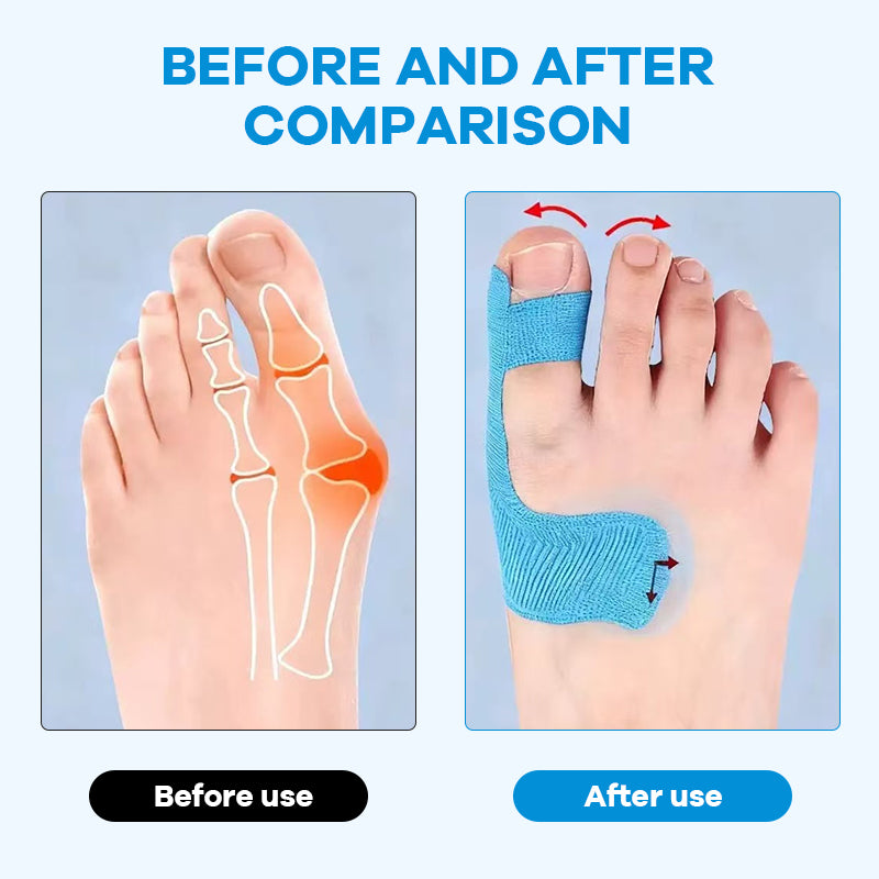 Aelln Bunion Relief Toe Correction Wrap