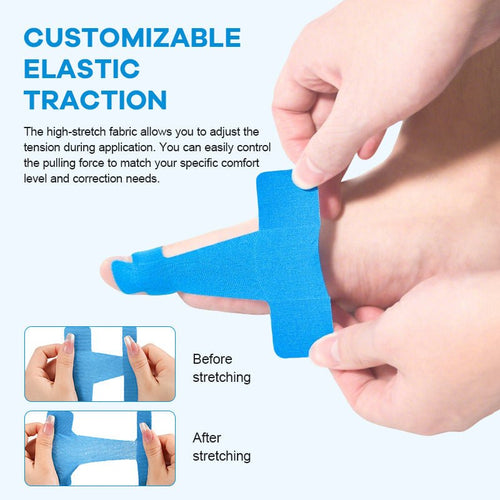 Aelln Bunion Relief Toe Correction Wrap