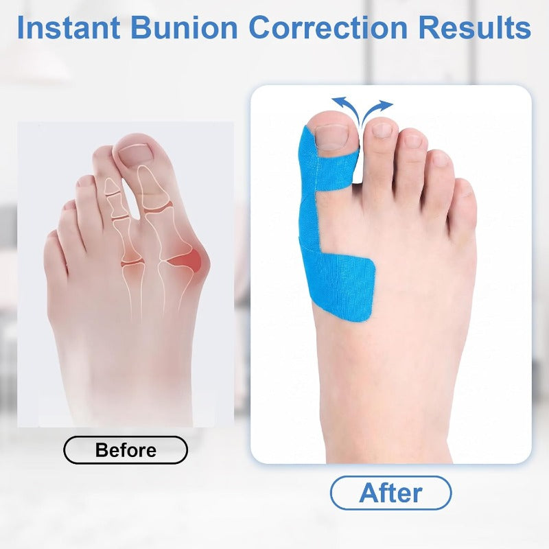 Cartivra Flexible Big Toe Alignment Support