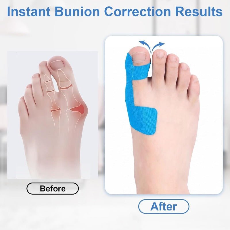 Cartivra Flexible Big Toe Alignment Support